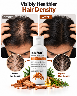 Hair Thinning Control, Scalp Flake Defense & Follicle Strengthening Oil – Cedarwood Infused Wood-Pressed Coconut Oil (100 ml)