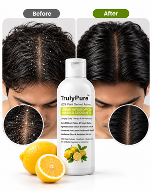 Lemon Infused Wood Pressed Coconut Oil