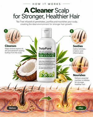 Tea Tree Infused Hair & Scalp Oil: Anti-Dandruff & Soothing Therapy for Flakes, Itchiness & Excess Sebum