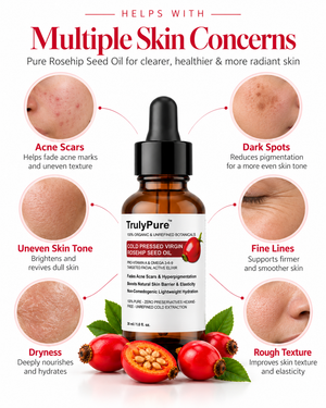 rosehip-seed-oi-for-hyeperpegmentation