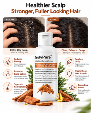 Hair Thinning Control, Scalp Flake Defense & Follicle Strengthening Oil – Cedarwood Infused Wood-Pressed Coconut Oil (100 ml)
