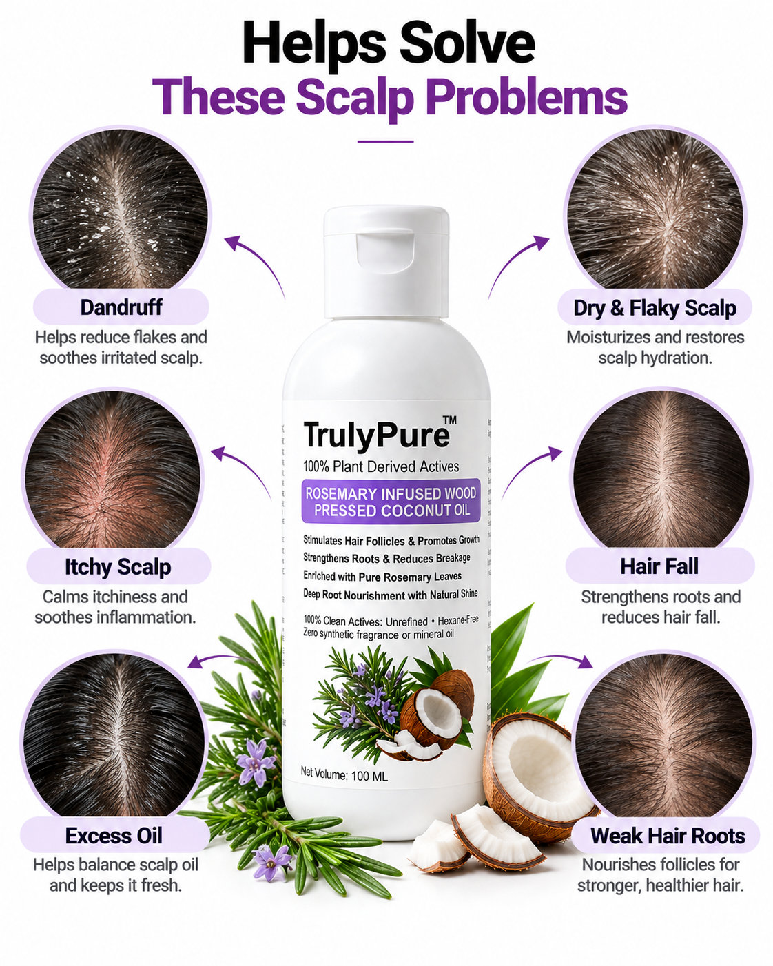 Hair Regrowth, Follicle Stimulation & Dandruff Control – Rosemary Infused Wood-Pressed Coconut Oil (100 ml)