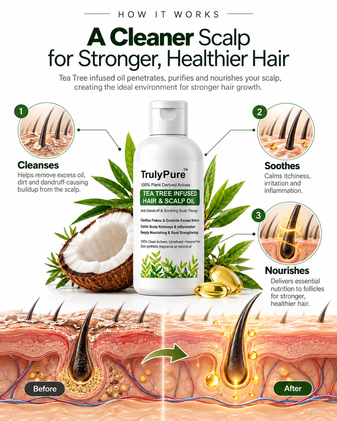 Tea Tree Infused Hair & Scalp Oil: Anti-Dandruff & Soothing Therapy for Flakes, Itchiness & Excess Sebum