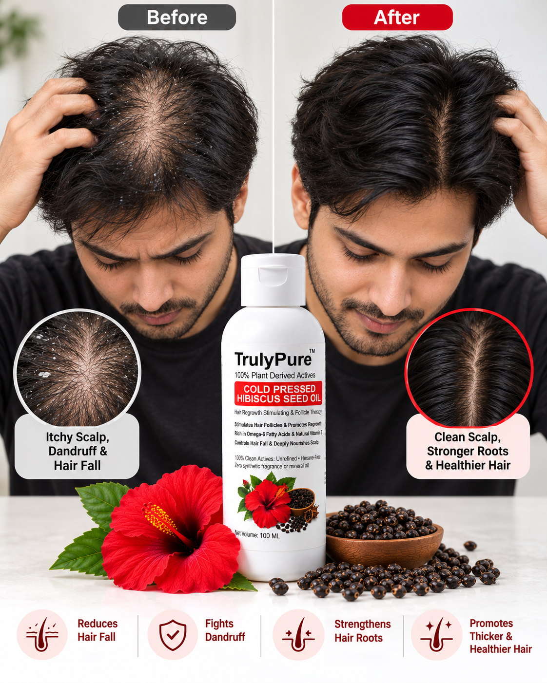 Hair Fall Control, Scalp Strengthening & Density Boosting Oil – TrulyPure™ Cold Pressed Virgin Hibiscus Seed Hair Oil (100 ml)