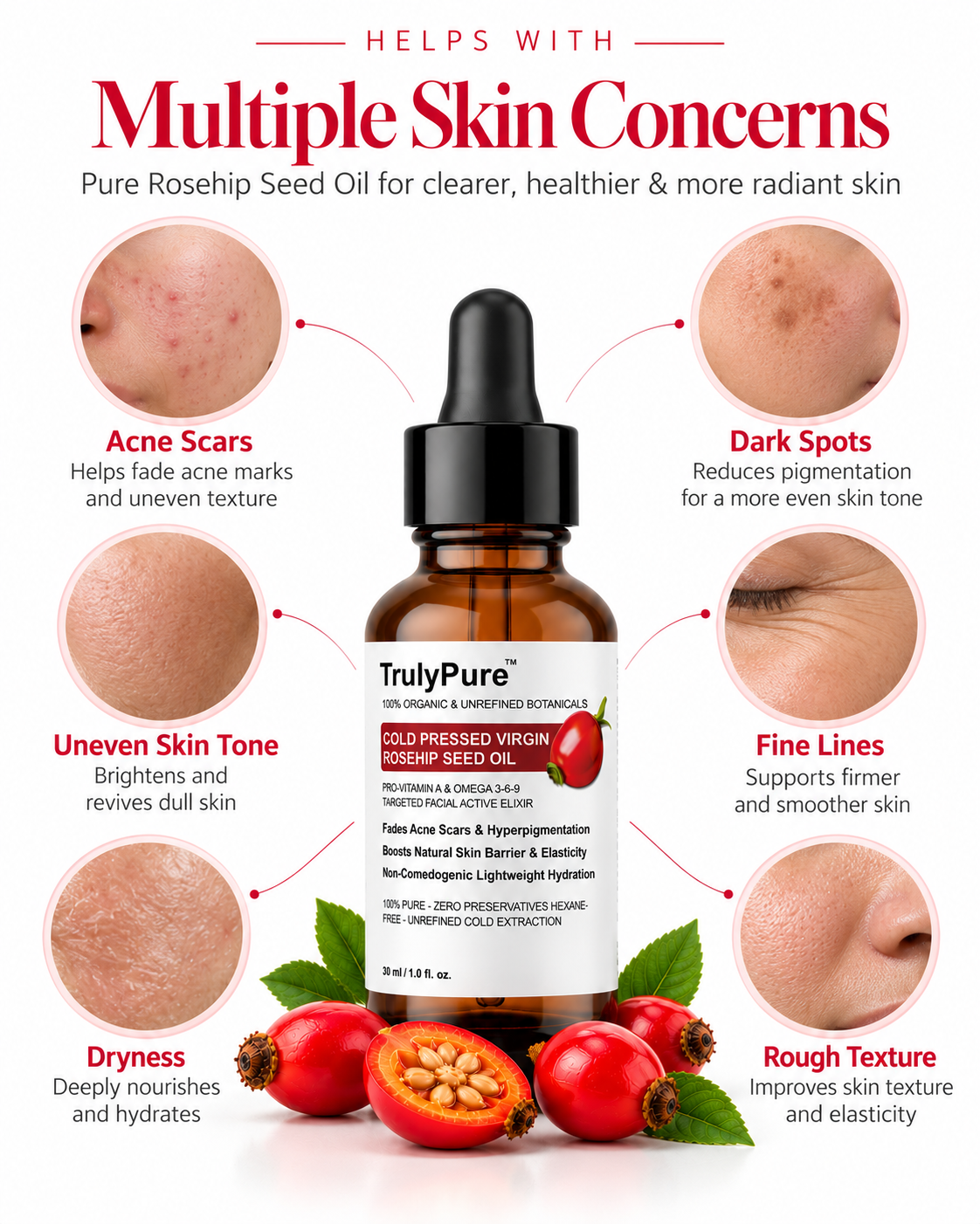 rosehip-seed-oi-for-hyeperpegmentation