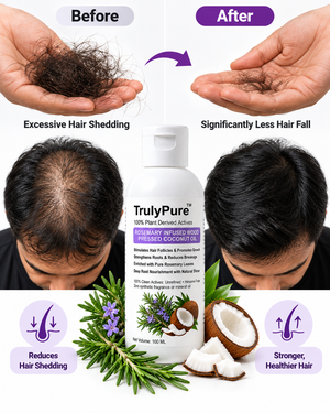 Hair Regrowth, Follicle Stimulation & Dandruff Control – Rosemary Infused Wood-Pressed Coconut Oil (100 ml)